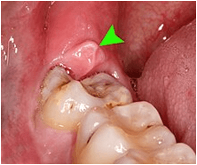 Intraoral Photo