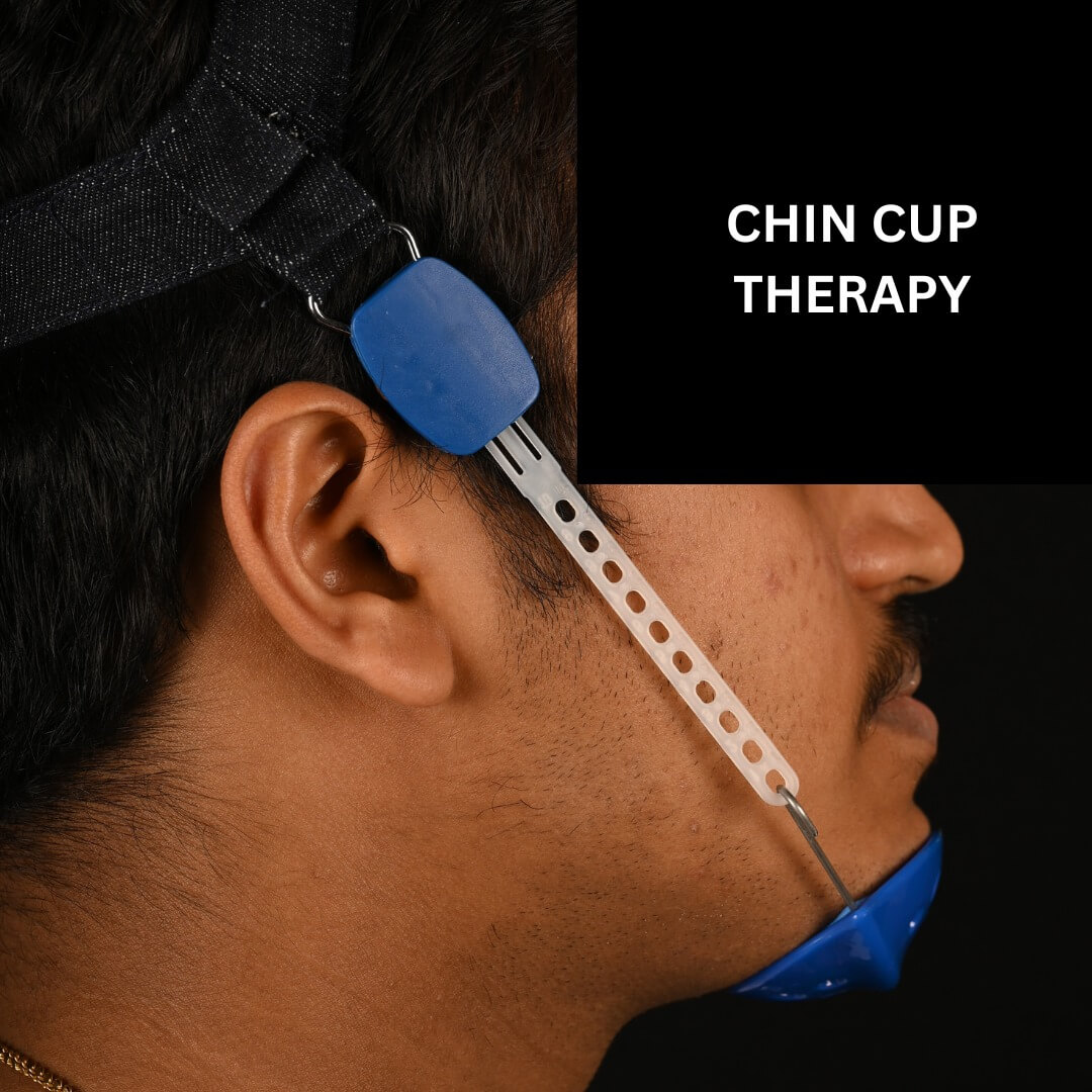 Chin Cup Therapy