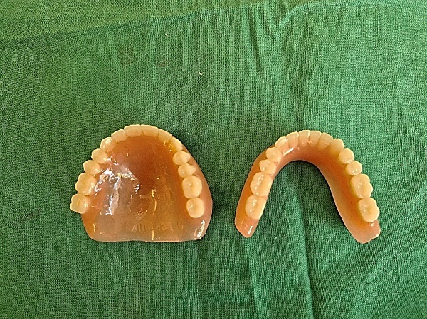 Denture